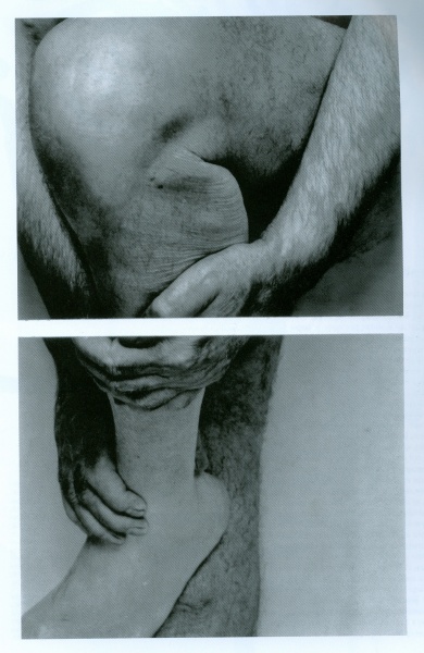 1993.John.Coplans.autoportrait.genous.et.mains.jpg